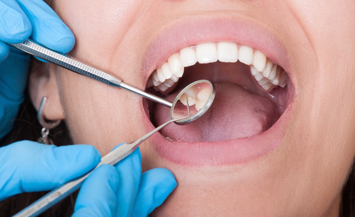 Dentures